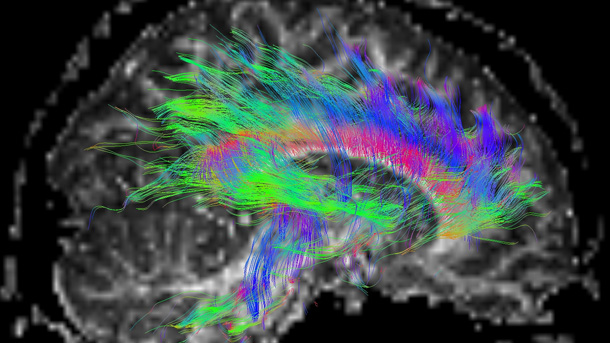 Poster Imaging
