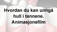 Hvordan du kan unng� hull i tennene - animasjonsfilm